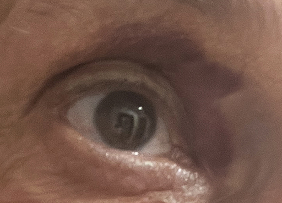 Trees, a shiner, Irma La Douce / Arboles, un ojo Morado, Irma La Douce